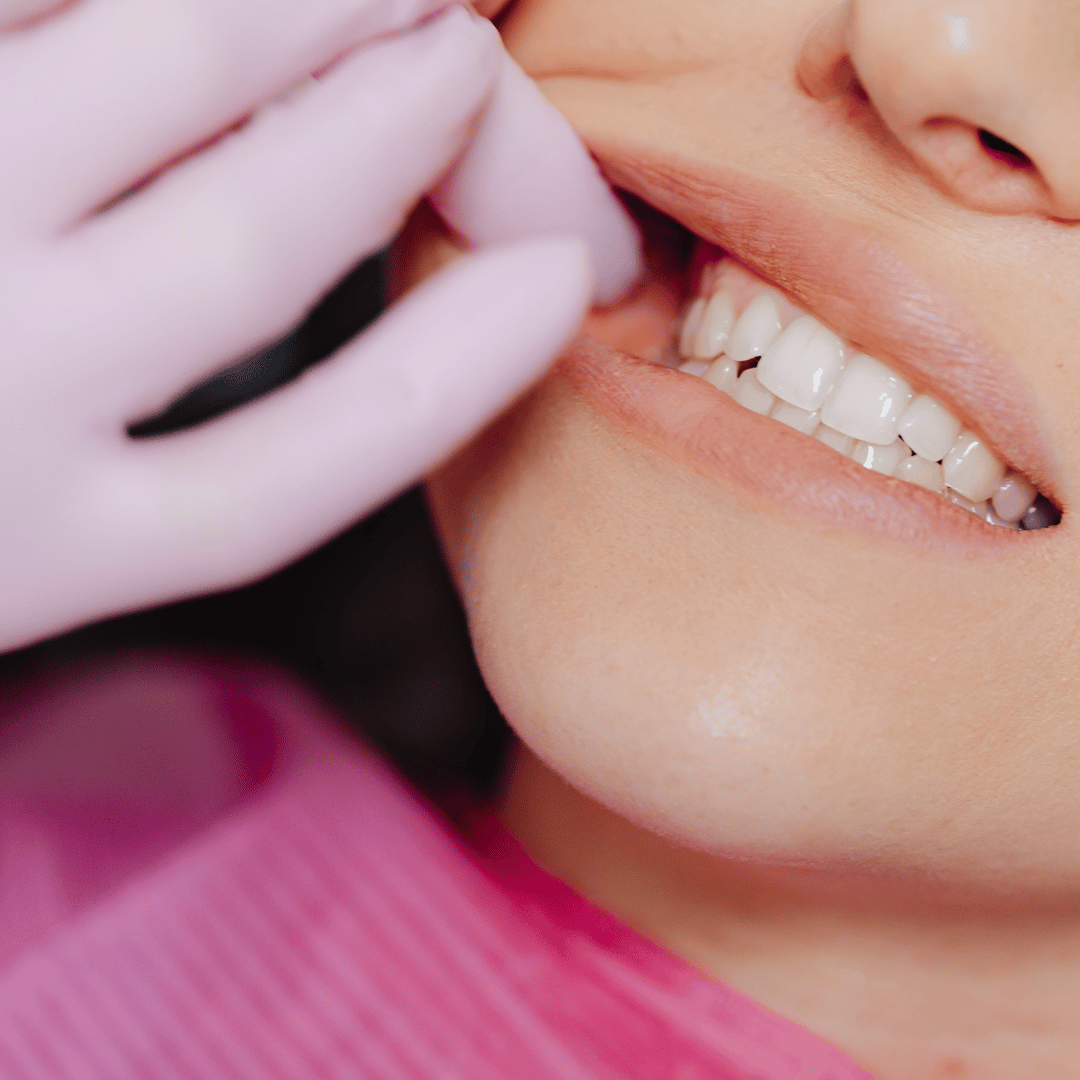 Les bienfaits du collagène pour les dents