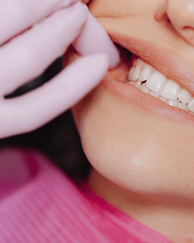 Les bienfaits du collagène pour les dents