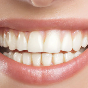 Faut-il prendre du collagène pour les gencives et les dents ?