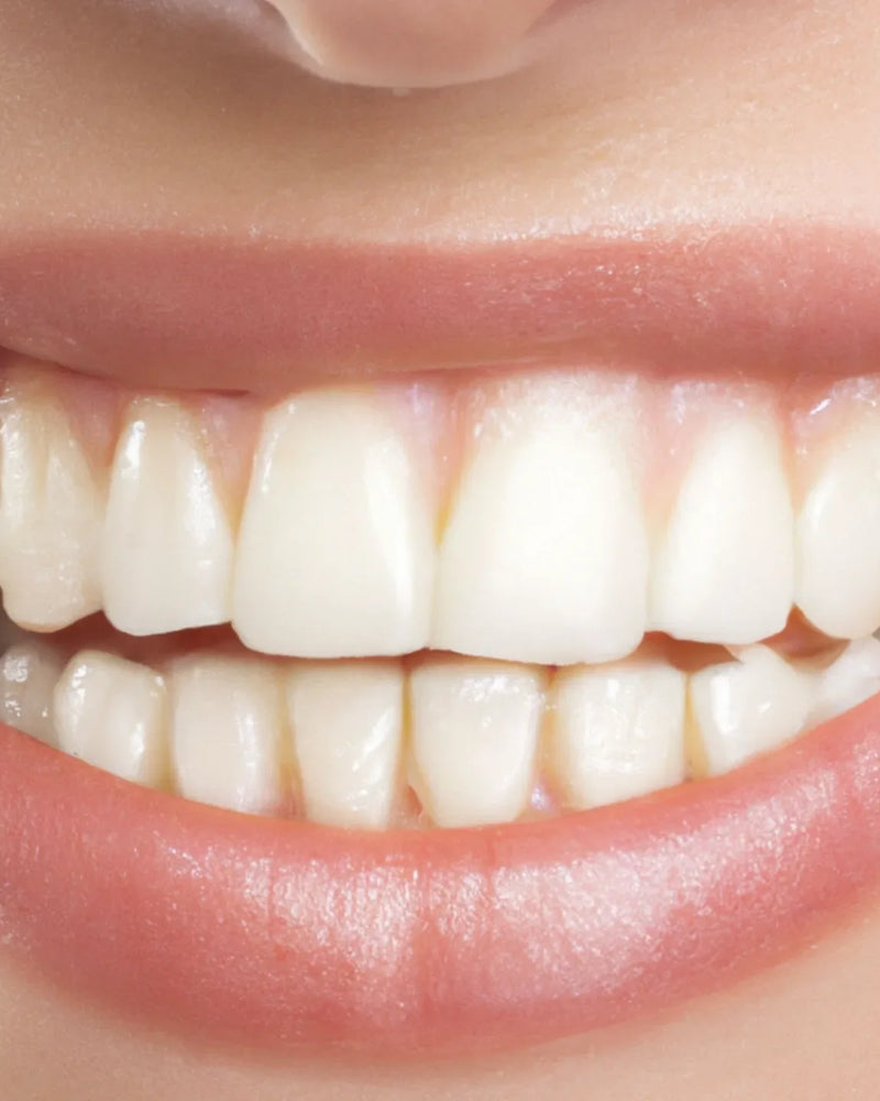 Faut-il prendre du collagène pour les gencives et les dents ?