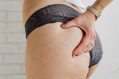 Collagene, cicatrici e smagliature: qual è il legame e può essere utile?